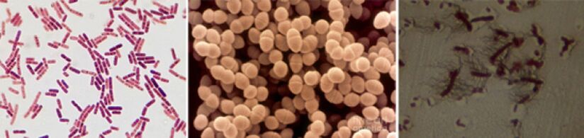 Escherichia sticks, fecal enterococcus and pro - main pathogens chronic bacterial prostatitis