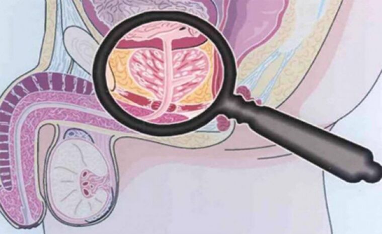 Prostate and his location