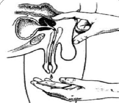 Prostate massage to obtain secrets